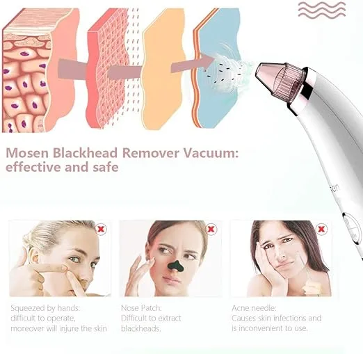 Mosen M1905 Blackhead Remover -Pink,5 Adjustable Level